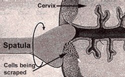 Pap Smear Technique